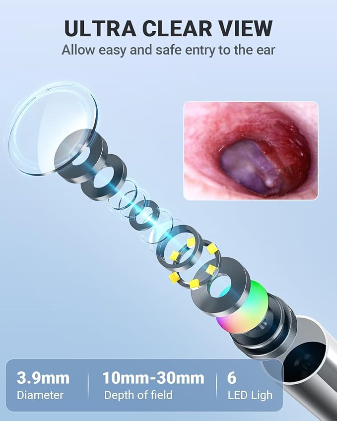 Anykit Digital Otoscope with Gyroscope, 4 Inches Screen, 3.9mm Ear Scope Camera - Image 5