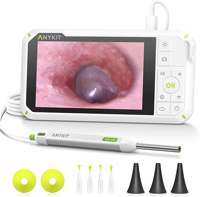 Anykit Digital Otoscope with Gyroscope, 4 Inches Screen, 3.9mm Ear Scope Camera by ANYKIT