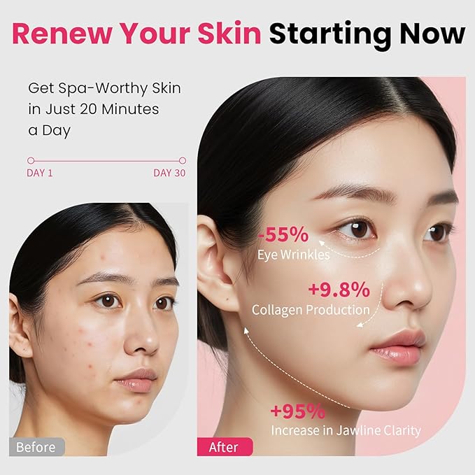 Face Lift Device – 8 in 1 Skin Tightening and Lifting, LED Light Therapy - Image 3