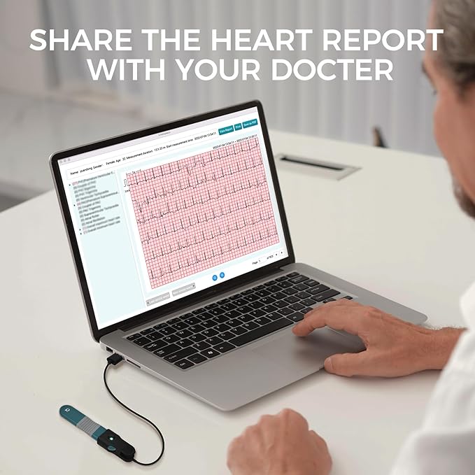 Livenpace 1-Lead Heart Health Monitor at Home, Portable 24 Hours Chest Lead - Image 3