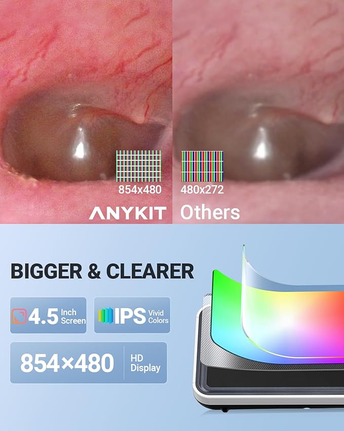 Anykit Digital Otoscope with Gyroscope, 4.5 Inches Screen, 3.9mm Ear Scope - Image 5