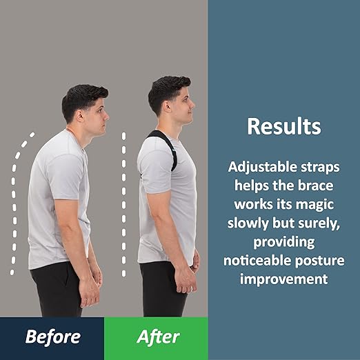 ComfyBrace Posture Corrector-Back Brace - Image 2