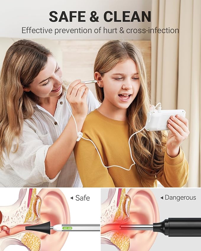 Anykit Digital Otoscope with Gyroscope, 4 Inches Screen, 3.9mm Ear Scope Camera - Image 4