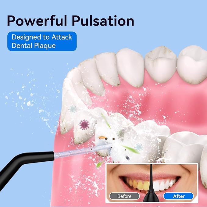 Cordless Portable Water Flosser - Image 3