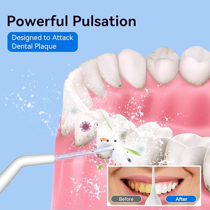 Cordless Portable Water Flosser - Image 3