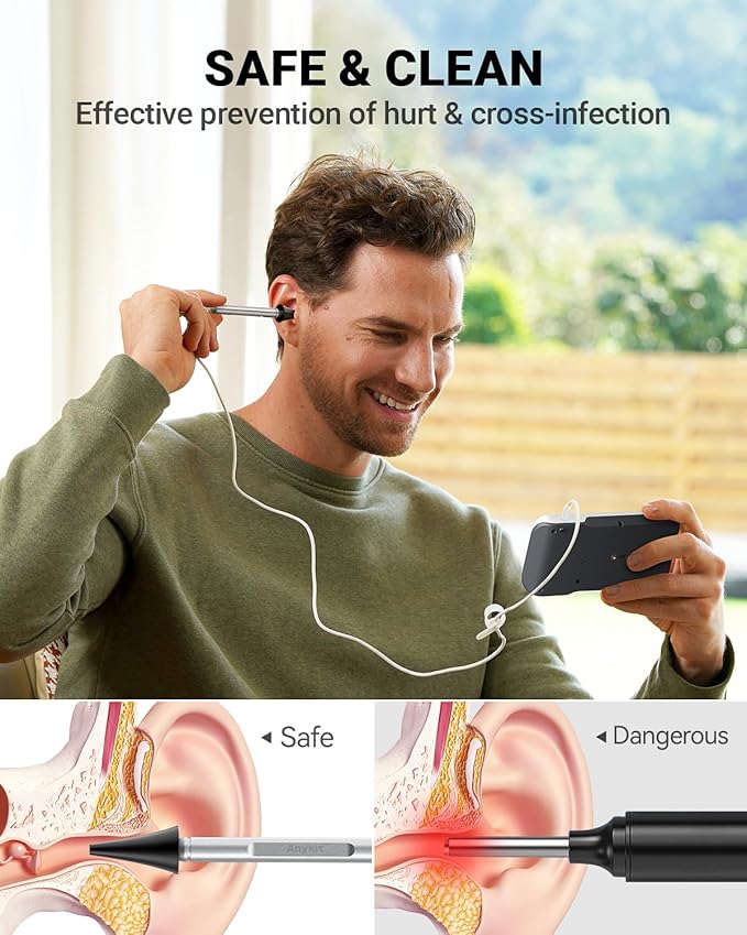 Anykit Digital Otoscope with Gyroscope, 4.5 Inches Screen, 3.9mm Ear Scope - Image 3