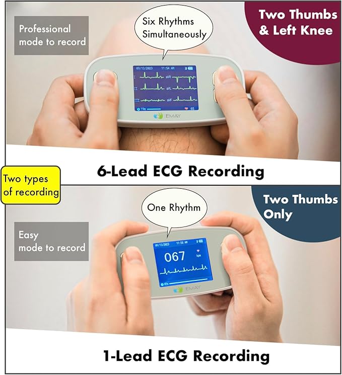 EMAY 6L Portable ECG Monitor | Record ECG and Heart Rate in 6 Channels | - Image 5