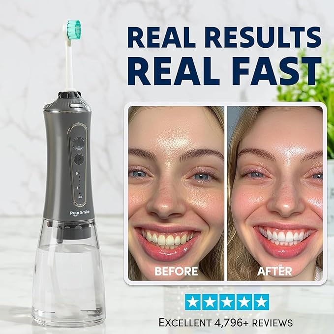 Professional Water Flosser - Image 5