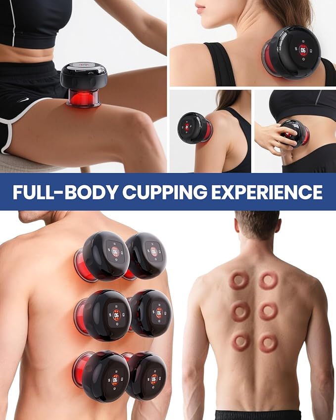 EURPMASK Choose the color of europe 5-in-1 Electric Cupping Kit - Image 3