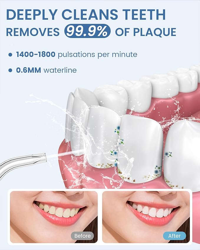 AUIEI Water Flosser Teeth Pick: 9 Jet Tips Cordless Oral Irrigator - Image 2