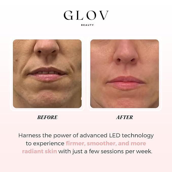 Glov Beauty - Anti-Aging LED Face Mask Red Light Therapy - Image 2