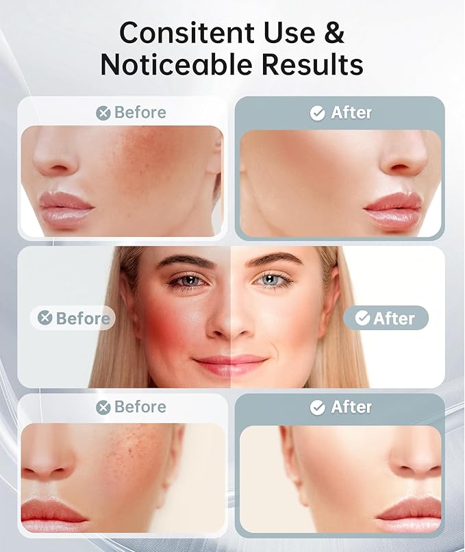 Dopsikn Red Light Therapy for Face and Neck, 7 Color Facial Massager - Image 3