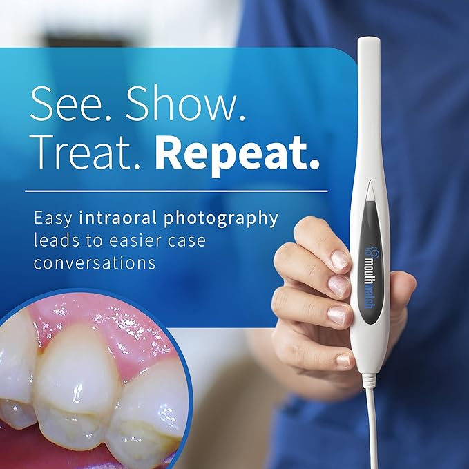 MouthWatch Intraoral Camera, Crystal Clear Images - Image 2