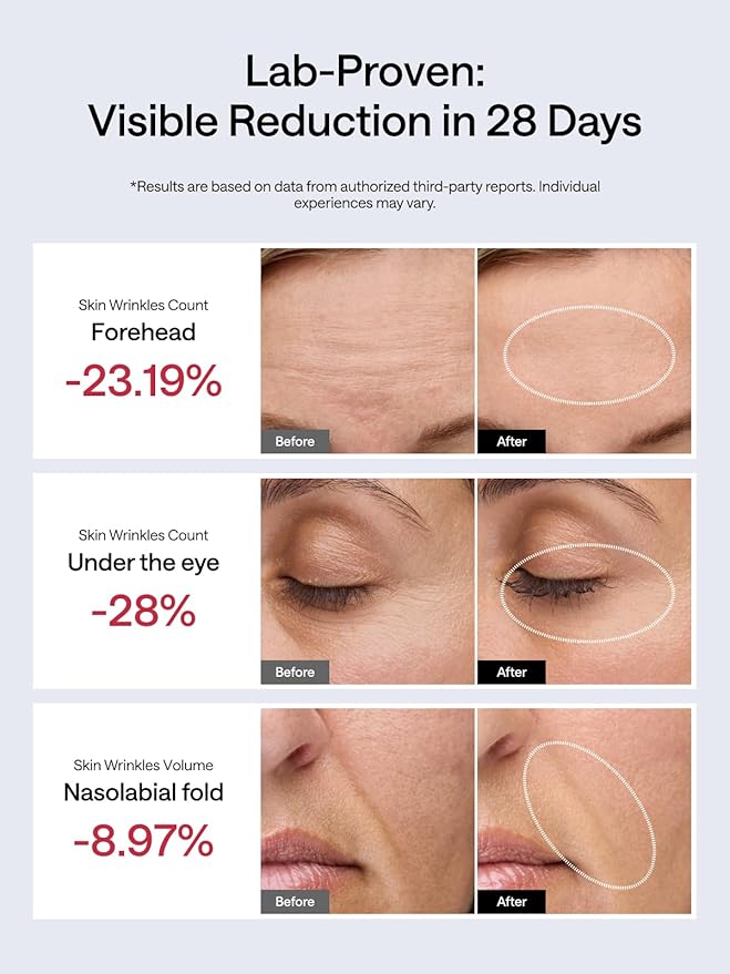 NouvelleSkin Facial Toning Device Facial, Microcurrent Facial Device - Image 3