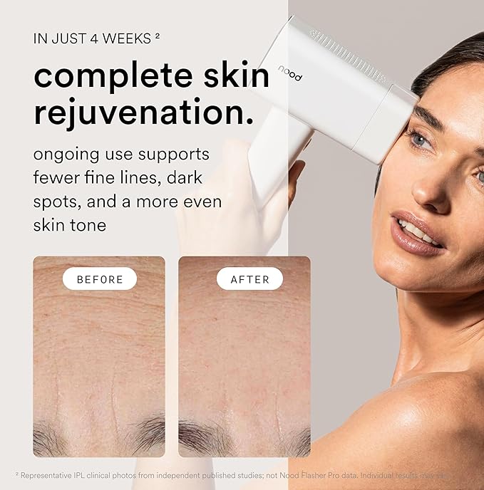 Nood™ NEW Flasher Pro — IPL Laser Hair Removal Device & Anti-Aging Red Light - Image 4
