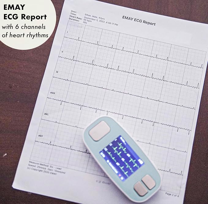 EMAY 6L Portable ECG Monitor | Record ECG and Heart Rate in 6 Channels | - Image 7