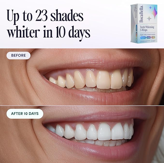 Boca Bella Teeth Whitening U-Wraps – 10 Treatments – 15% Hydrogen Peroxide - Image 4
