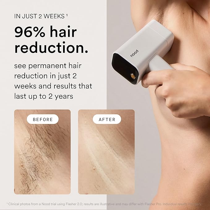 Nood™ NEW Flasher Pro — IPL Laser Hair Removal Device & Anti-Aging Red Light - Image 3