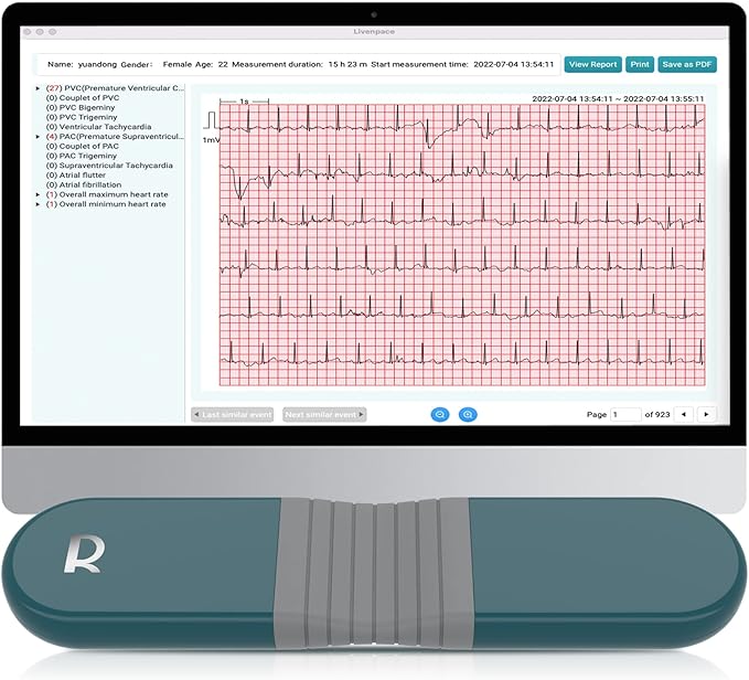 Livenpace 1-Lead Heart Health Monitor at Home, Portable 24 Hours Chest Lead by Livenpace