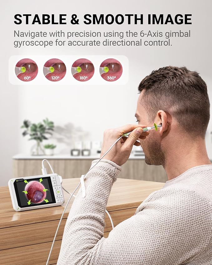 Anykit Digital Otoscope with Gyroscope, 4 Inches Screen, 3.9mm Ear Scope Camera - Image 3